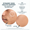 PRAVOLABS® – SAFE INTERNAL SKIN SUPPORT