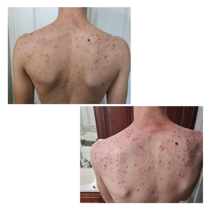 PRAVOLABS® – CLEAR SKIN FORMULA