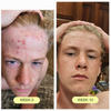 PRAVOLABS® – SAFE INTERNAL SKIN SUPPORT