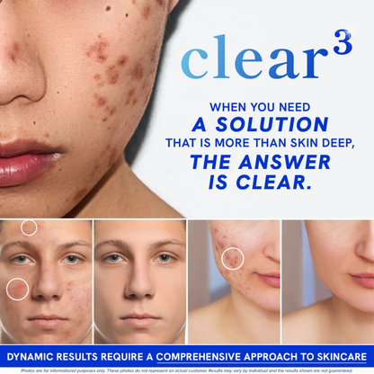 PRAVOLABS® – CLEAR SKIN FORMULA