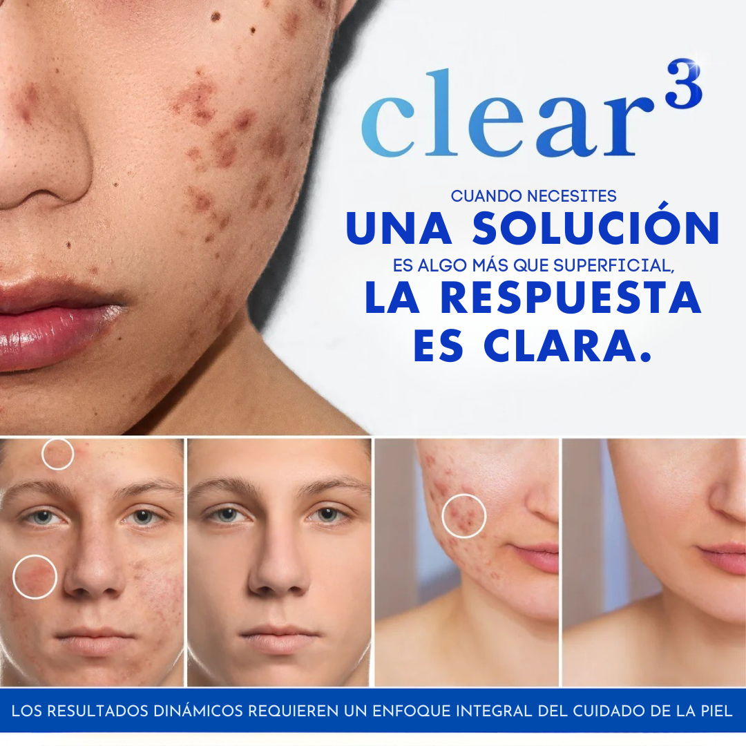 PRAVOLABS® – APOYO HORMONAL PARA LA PIEL