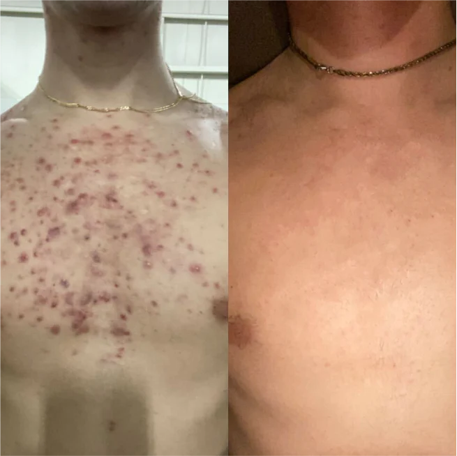 PRAVOLABS® - BOOST YOUR TESTOSTERONE NATURALLY